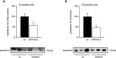 Salivary <mark class="highlighted">Lactoferrin</mark> Expression in a Mouse Model of Alzheimer’s Disease